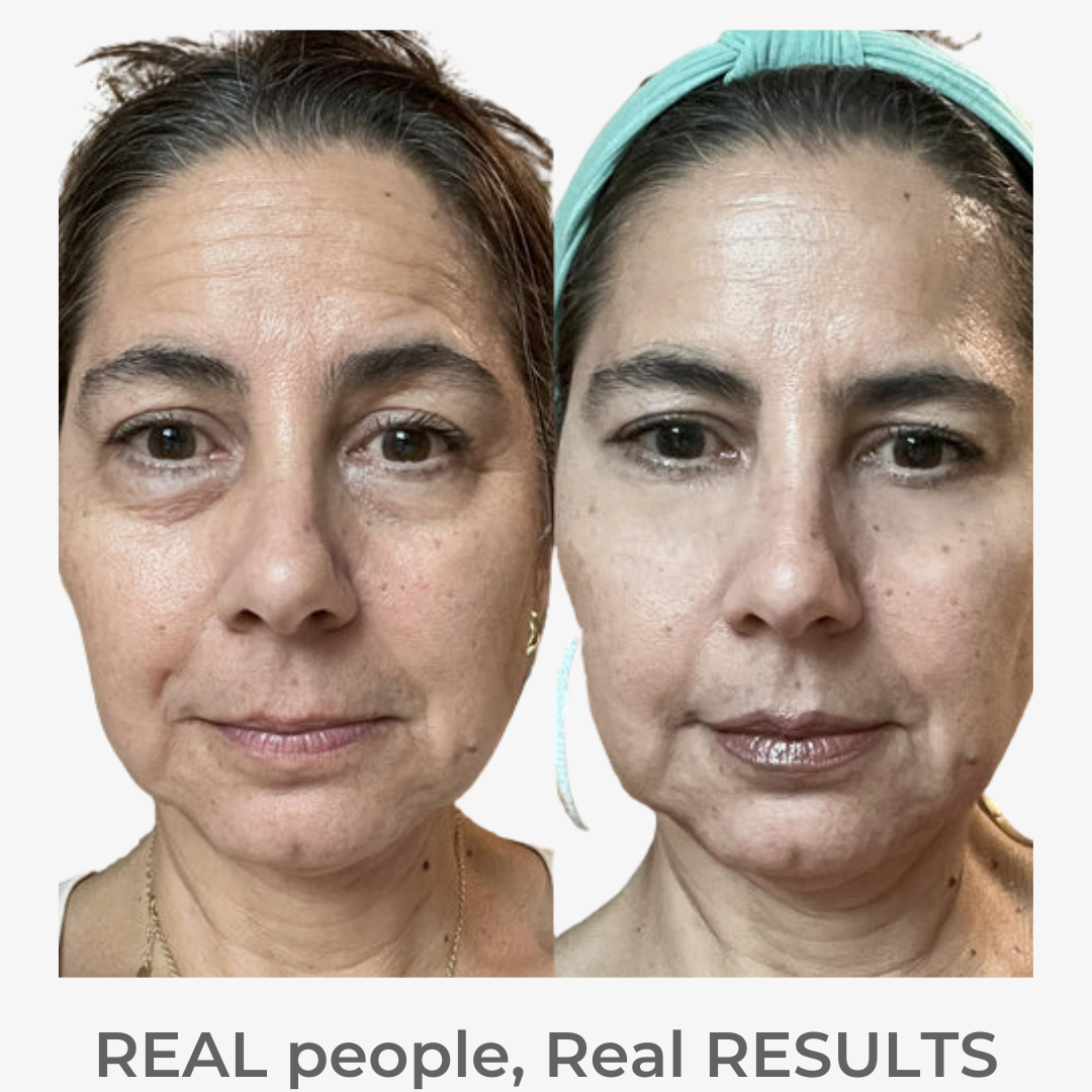 RevitalEyes™