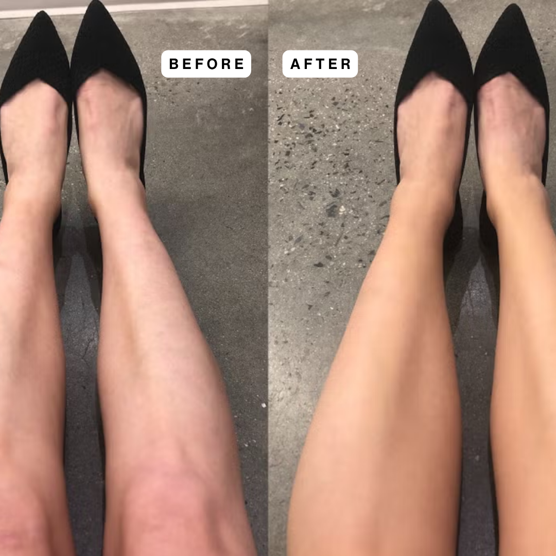 Elevon™ Body Coverage Perfector