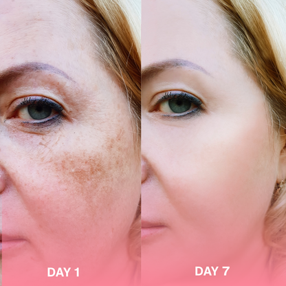 Turmeric Kojic Acid Pads