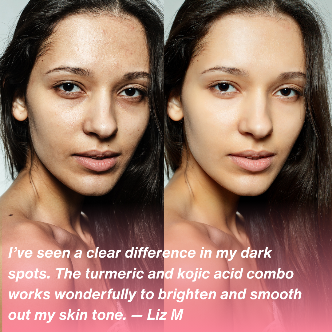 Turmeric Kojic Acid Pads