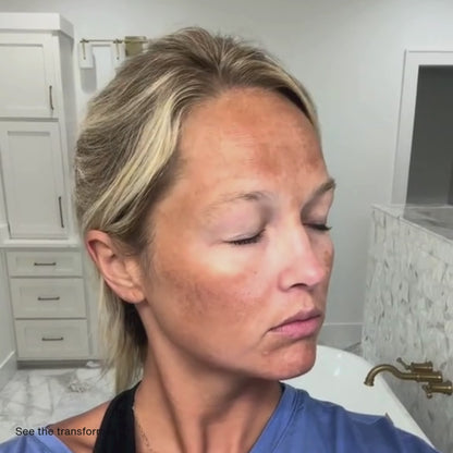 Turmeric Kojic Acid Pads